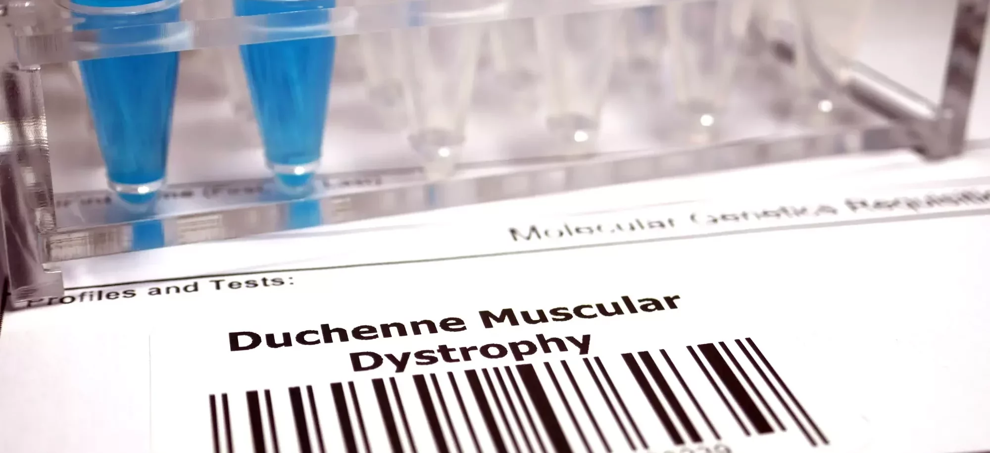 etude-dystrophie-duchenne